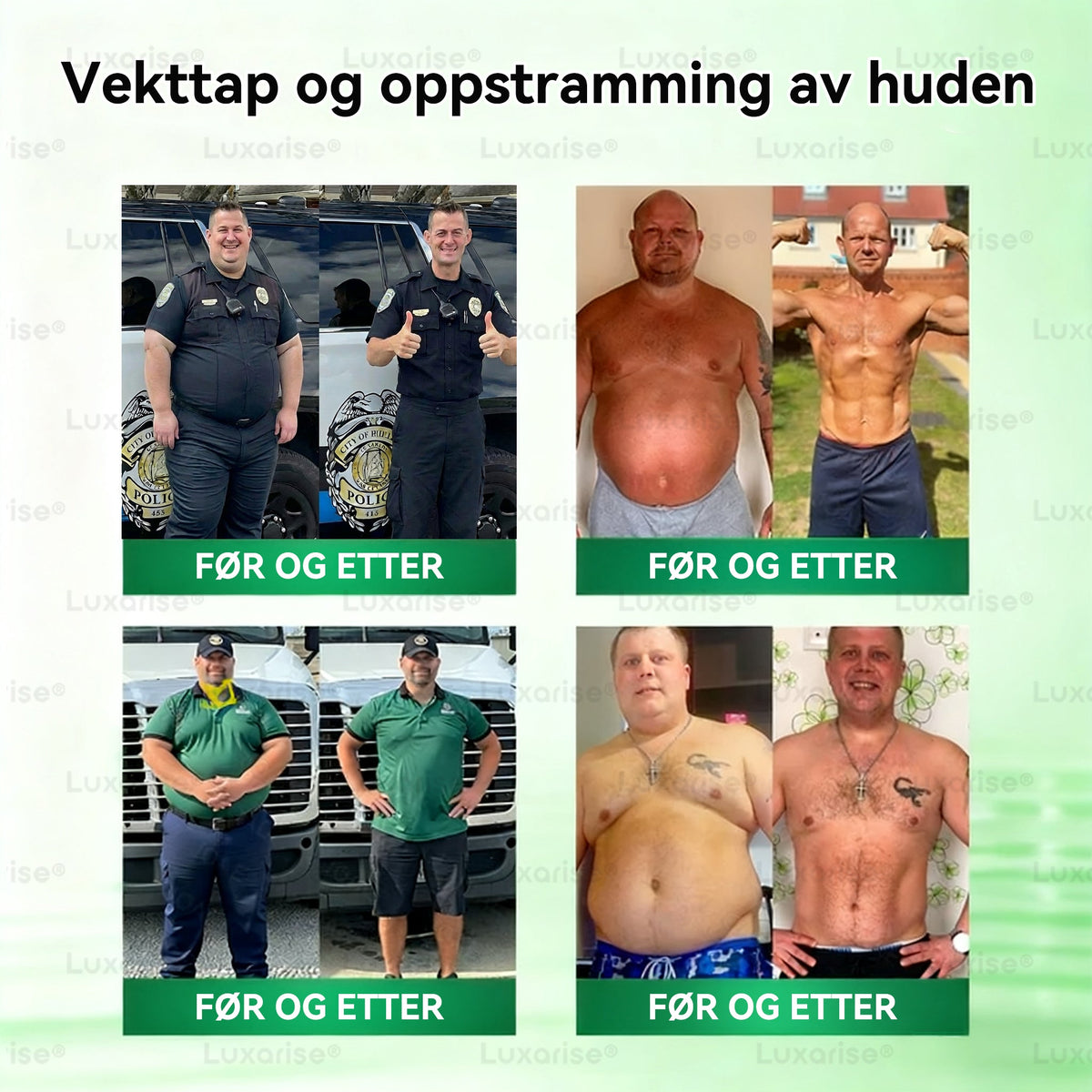 Offisielt ekte produkt✅𝐿𝑢𝑥𝑎𝑟𝑖𝑠𝑒® 𝑀𝑜𝑟𝑖𝑛𝑔𝑎 x 𝐵𝑒𝑟𝑏𝑒𝑟𝑖𝑛𝑒 10-𝑖-1 𝖠𝑣𝑎𝑛𝑠𝑒𝑟𝑡 𝑛𝑎𝑛𝑜-𝑚𝑖𝑘𝑟𝑜𝑛å𝑙𝑒𝑝𝑙𝑎𝑠𝑡𝑒𝑟 (𝑏𝑎𝑟𝑒 é𝑛 𝑔𝑎𝑛𝑔 𝑑𝑎𝑔𝑙𝑖𝑔, 𝑠𝑦𝑛𝑙𝑖𝑔𝑒 𝑒𝑛𝑑𝑟𝑖𝑛𝑔𝑒𝑟 𝑖 𝑙ø𝑝𝑒𝑡 𝑎𝑣 7 𝑑𝑎𝑔𝑒𝑟)🥦